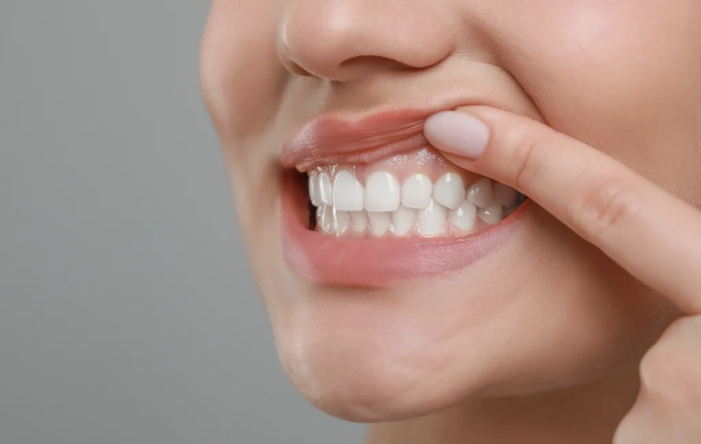 chirurgie guidee numerique juan les pins chirurgie guidee numerique juan les pins Alimentation Chirurgiens-dentistes à Juan-les-pins | Cabinet dentaire du Lys