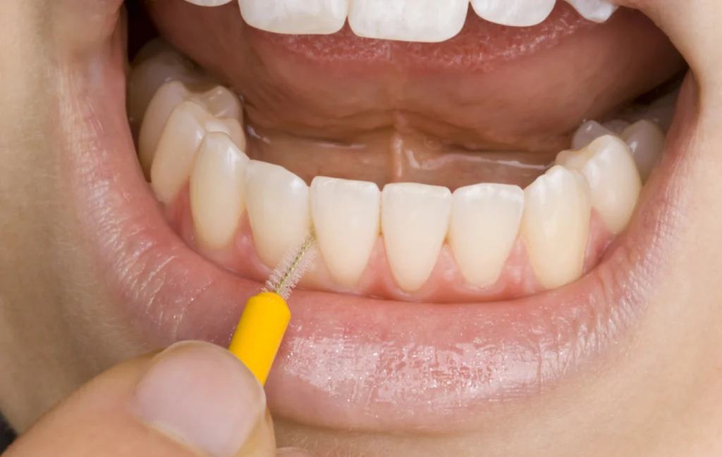 hygiene dentaire Soins médicaux des gencives Chirurgiens-dentistes à Juan-les-pins | Cabinet dentaire du Lys