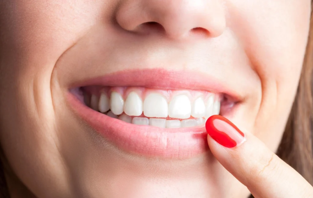 sourire dents blanches sourire dents blanches Couronnes céramique Chirurgiens-dentistes à Juan-les-pins | Cabinet dentaire du Lys