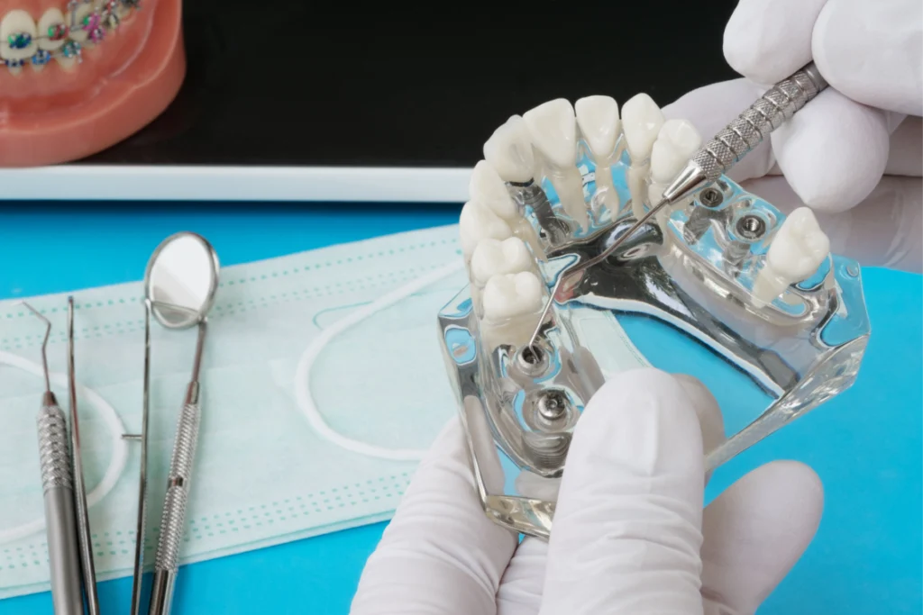 chirurgie guidee cas complexes juan les pins Chirurgie guidée Chirurgiens-dentistes à Juan-les-pins | Cabinet dentaire du Lys