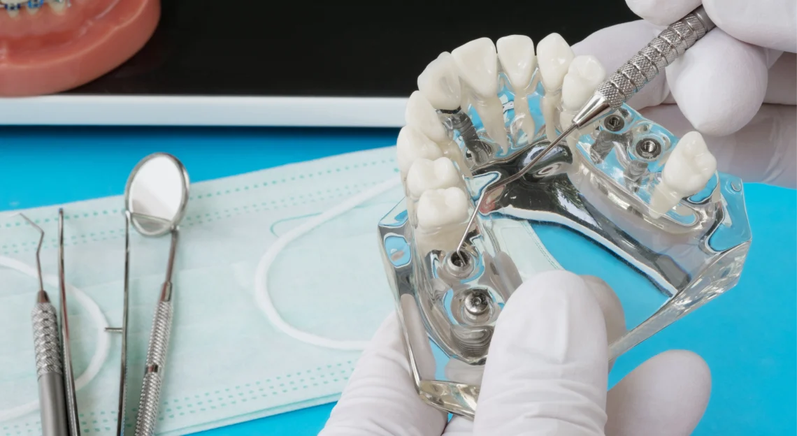 chirurgie guidee cas complexes juan les pins Chirurgie guidée Chirurgiens-dentistes à Juan-les-pins | Cabinet dentaire du Lys